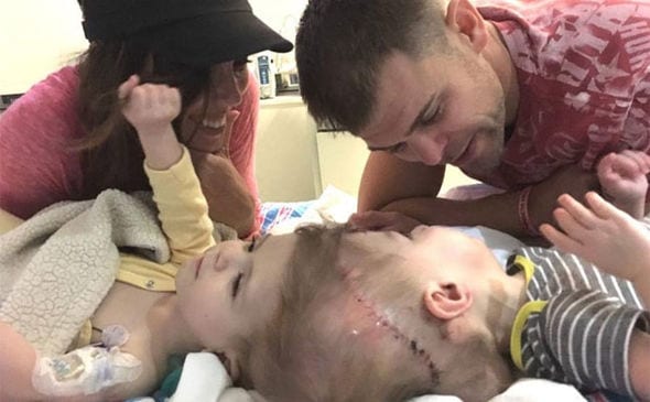 Photos: Des bébés siamois ont été séparés après 20 longues heures d'une opération chirurgicale