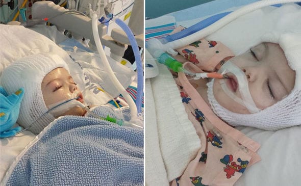 Photos: Des bébés siamois ont été séparés après 20 longues heures d'une opération chirurgicale
