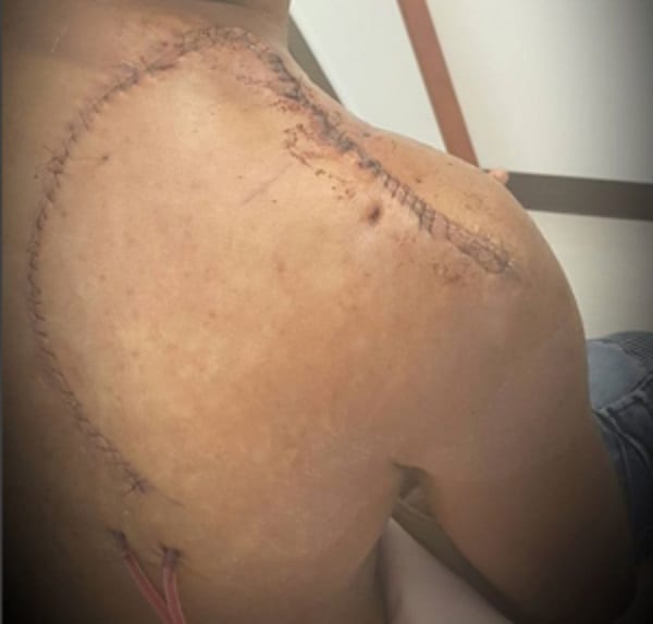 Banky W révèle comment il a survécu à un cancer de la peau (photos)