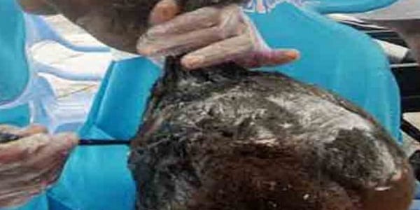 elle meurt suite à un défrisage