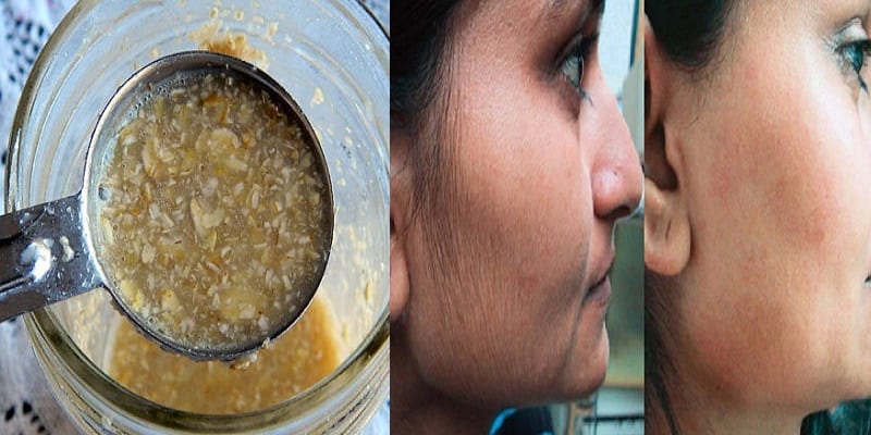 recette-pour-se-debarrasser-des-poils-du-visage-definitivement