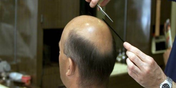 chauve-525952-jpg_358598