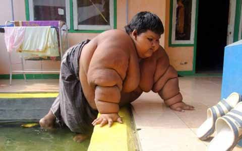 Incroyable : âgé de 10 ans, il pèse 192 kilos (photos)
