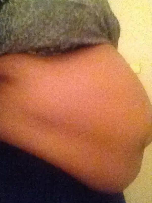 Âgée de 50 ans, elle dit être enceinte de 15 mois, les médecins disent qu'elle prend simplement du poids: PHOTOS