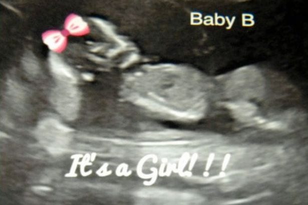 Un homme engendre '100 enfants' en quatre ans...Voici sa méthode