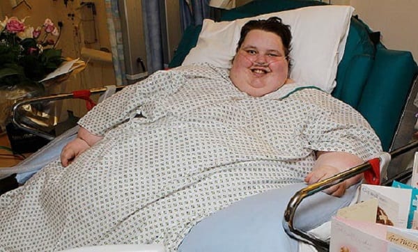 La plus grosse femme britannique pesant 254 Kg larguée par son petit ami, après une perte de poids