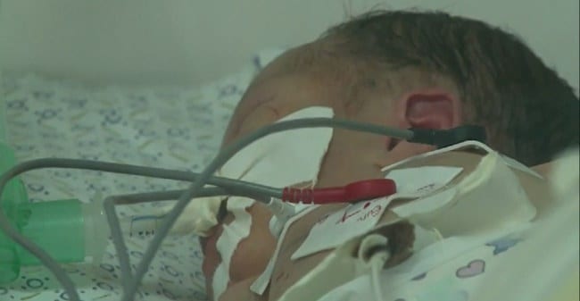 Un bébé sauvé du ventre de sa maman morte dans un bombardement... Vidéo