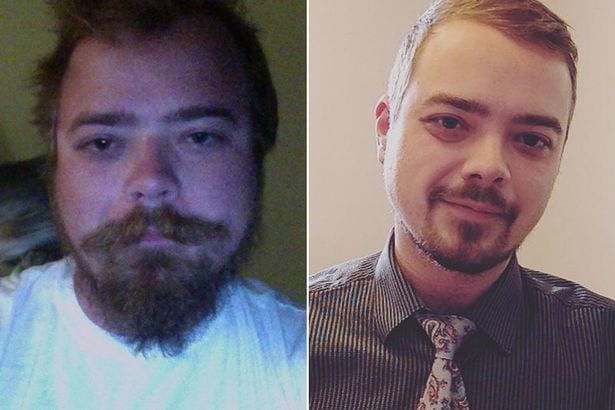 Découvrez des photos avant et après de personnes qui ont arrêté de boire de l'alcool