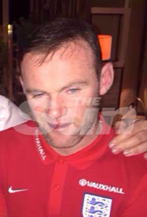 Wayne Rooney qui prétend être blessé, aperçu ivre et faisant la fête: PHOTOS