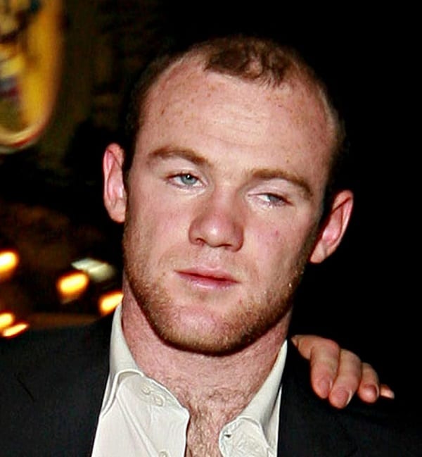 Wayne Rooney qui prétend être blessé, aperçu ivre et faisant la fête: PHOTOS