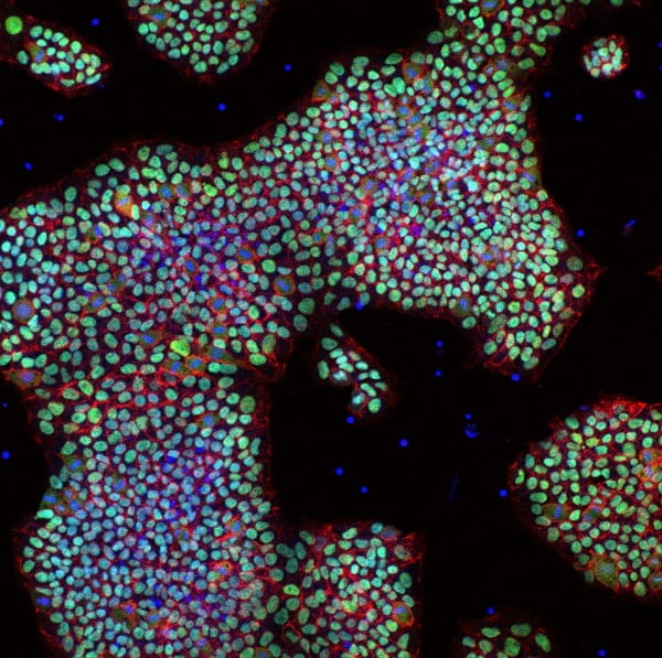 Cette découverte pourrait nous aider à régénérer les parties du corps humain