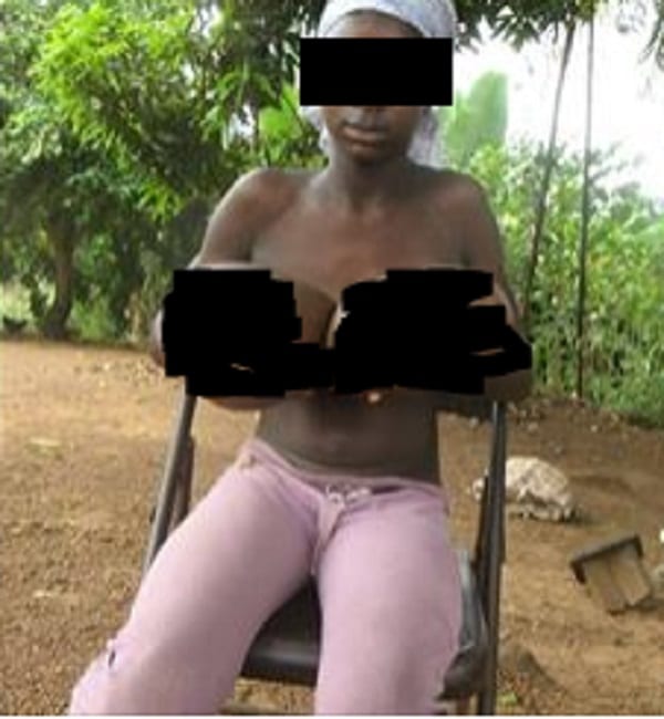 Sierra Leone: Une fille de 11 ans inquiète du volume de sa poitrine appelle à l'aide (PHOTOS)