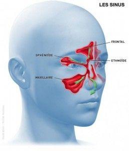 Comment se débarrasser de la sinusite naturellement?
