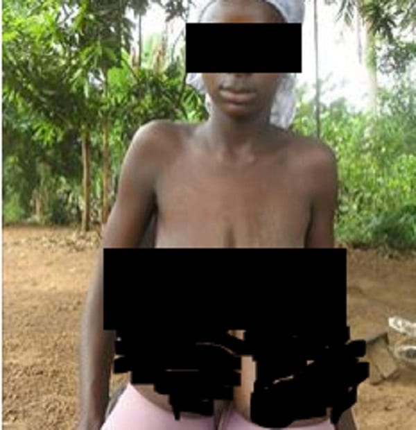 Sierra Leone: Une fille de 11 ans inquiète du volume de sa poitrine appelle à l'aide (PHOTOS)