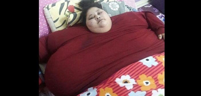 Égypte: la femme la plus grosse au monde perd 100 kilos après son opération