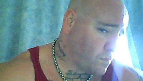 Un père brûle sa fille de 3 ans "parce qu'elle était trop belle": PHOTOS