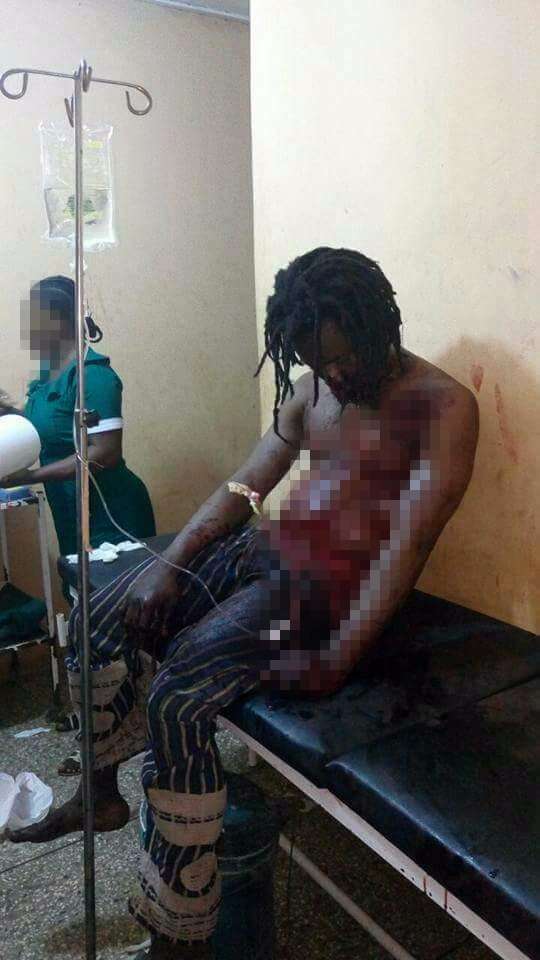 Ghana: Croyant en ses pouvoirs mystiques, un féticheur se retrouve à l’hôpital après avoir reçu des balles