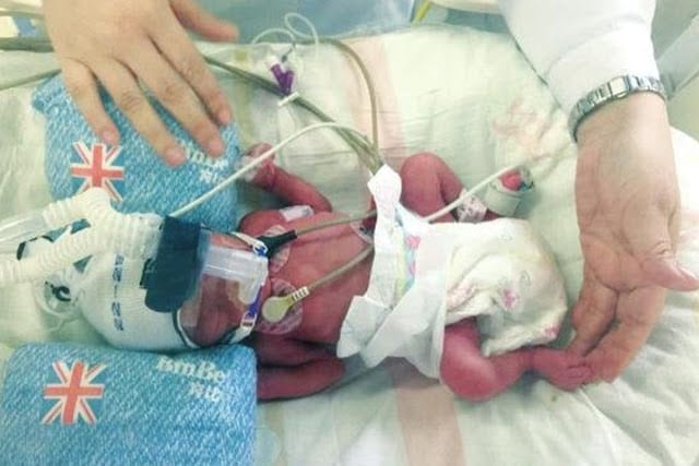 Chine: Une femme accouche deux fois en 7 jours (PHOTOS)