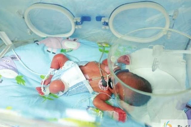 Chine: Une femme accouche deux fois en 7 jours (PHOTOS)