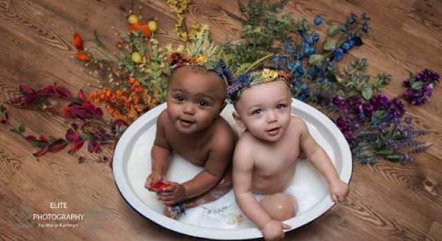 USA: des jumelles à la couleur de peau différente font le buzz