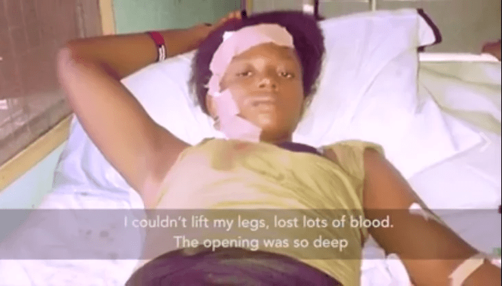 Déclarée morte après un accident, une femme "revient à la vie" sur le chemin de la morgue.