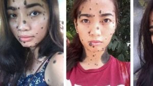 Traîtée de "monstre", elle pourrait devenir "Miss Univers". L'incroyable histoire d'Evita Patcey!