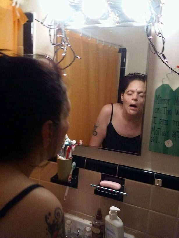 Une ex toxicomane détruite par la consommation abusive de drogues, partage des photos choquantes: PHOTOS