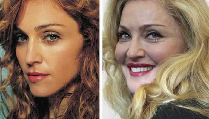 plastic-surgery-celebrities-2014-madonna-plastic-surgery-pictures—youtube-awesome