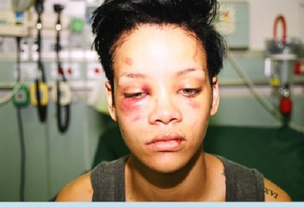 Chris Brown révèle finalement ce qui s'est passé le soir où il a battu Rihanna