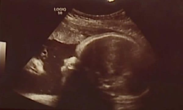 USA: un couple affirme avoir vu Jésus-Christ sur l'échographie de leur bébé (photos)