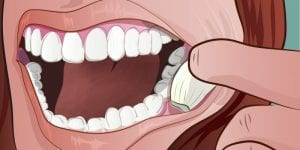Santé : Utilisez une gousse d'ail pour combattre les infections de dents