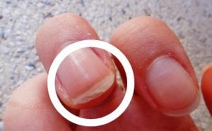 Voici 10 changements sur vos ongles qui pourraient cacher des problèmes de santé