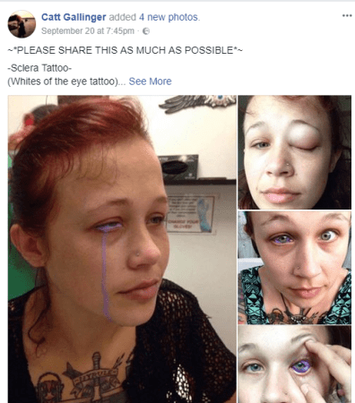 Canada : un tatouage dans l’œil laisse un mannequin de 24 ans presque aveugle (vidéo)