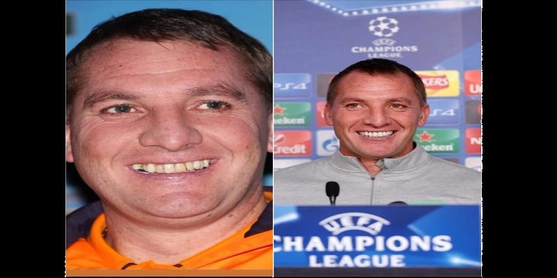 Découvrez ces célébrités du football qui ont refait leur dentition (photos)