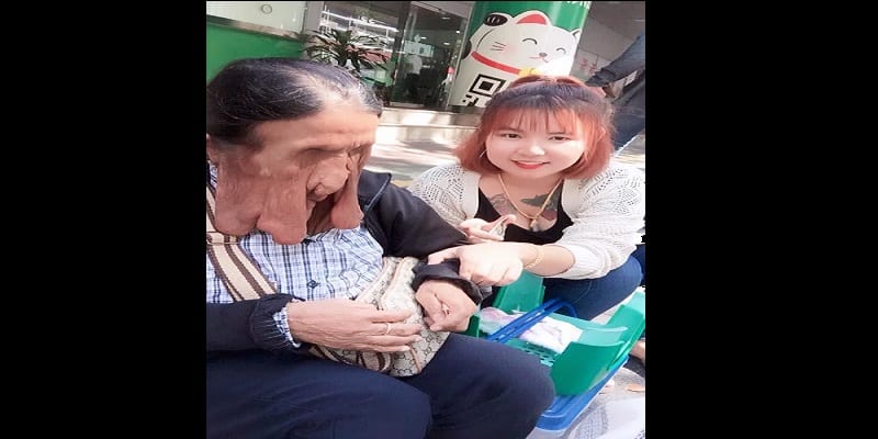Thaïlande : cette grand-mère souffre d’une maladie qui fait fondre son visage (photos)