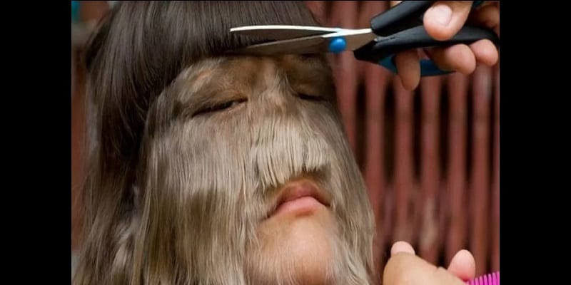 Thaïlande : La fille la plus velue au monde bientôt mariée (photos)