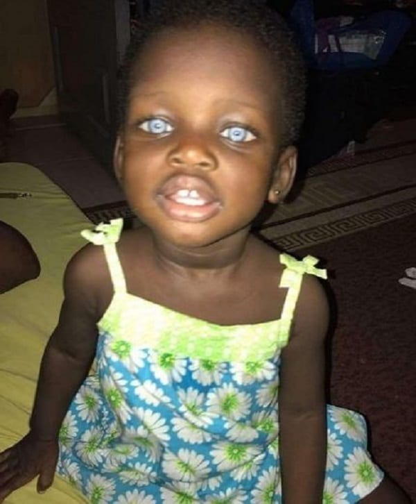 Ghana: Une fillette née avec des yeux bleus traitée de ''sorcière'' (PHOTOS)