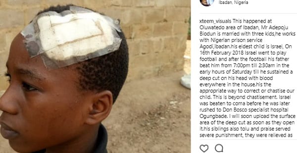 Nigeria: Un homme bat son fils pour avoir joué au football