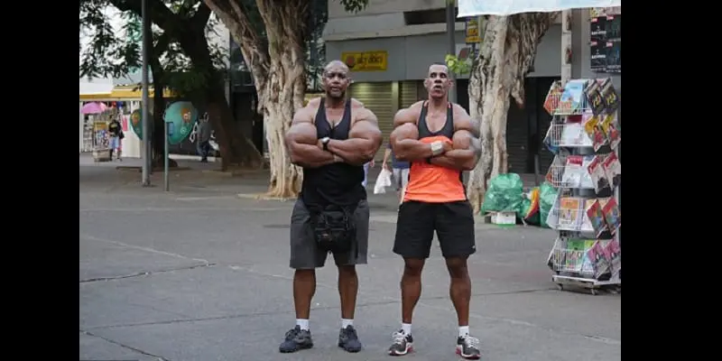Brésil-insolite : ils s'injectent des produits chimiques pour gonfler leurs biceps (photos)