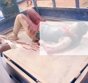 Côte d'Ivoire: L'homme qui a tailladé sa petite amie à la machette arrêté