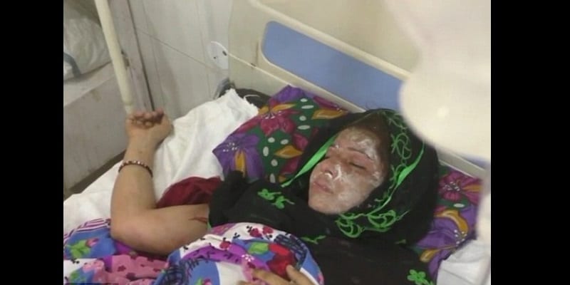 Inde-insolite : un homme verse de l’acide sur sa femme pour avoir donné naissance à une fille (vidéo)