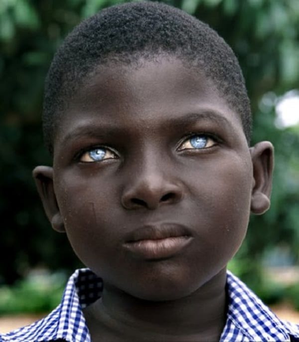 African Boy Blue Eyes - Découvrez pourquoi certains africains noirs ont les yeux bleus