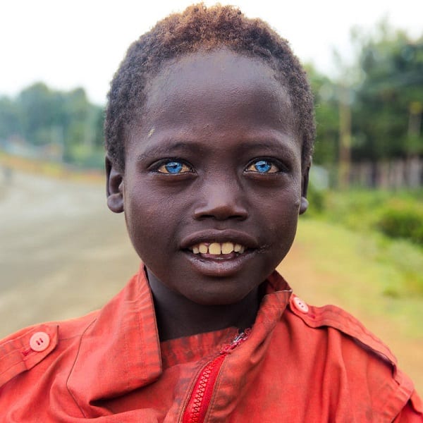 YEUX BLEUS 1 - Découvrez pourquoi certains africains noirs ont les yeux bleus