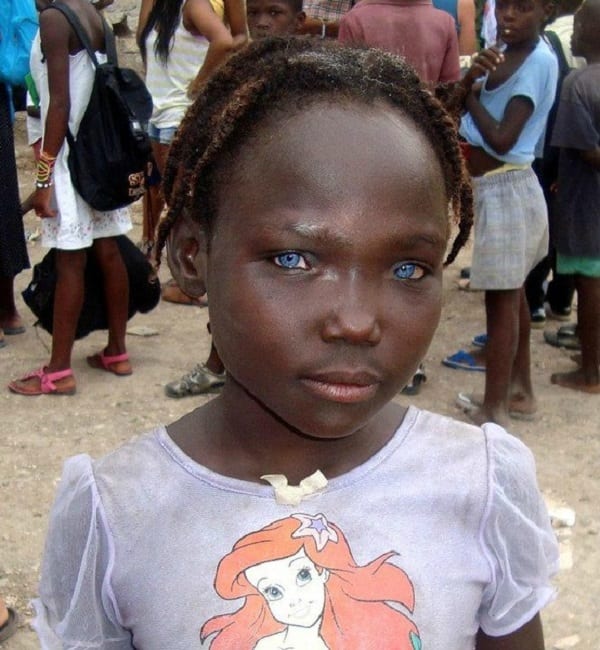 a3d98ae853adba424f0b7d91b7493e23 - Découvrez pourquoi certains africains noirs ont les yeux bleus
