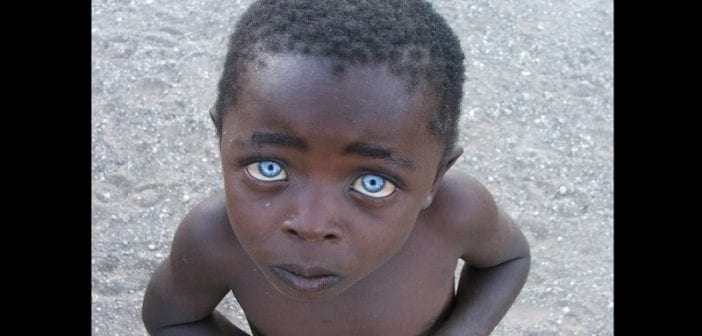 yeux bleus