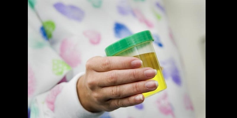 Voici ce que la couleur de votre urine révèle sur votre état de santé