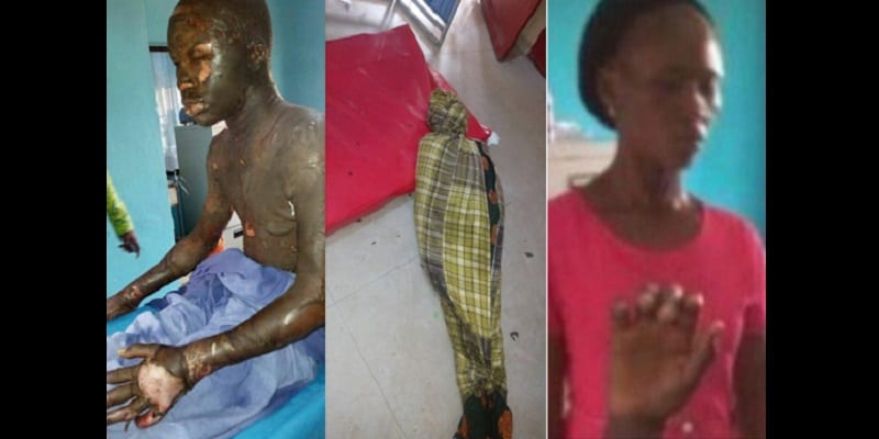 Nigeria : Une mère brûle son fils de 13 ans (photos)