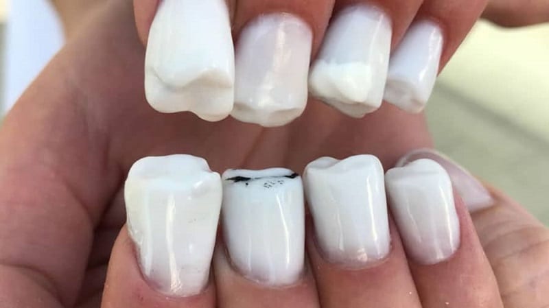 ongles-dents-manucure-tuto