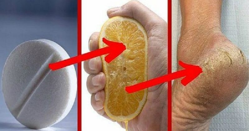 Voici-le-secret-pour-eliminer-les-callosites-et-les-champignons-des-pieds-en-2-jours-600×375