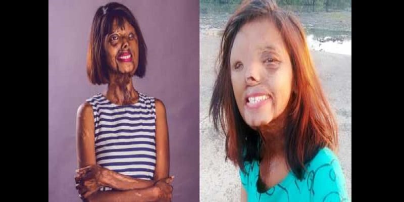 Lady-doused-in-acid-by-her-dad-because-he-wanted-a-son-shares-inspiring-new-year-message